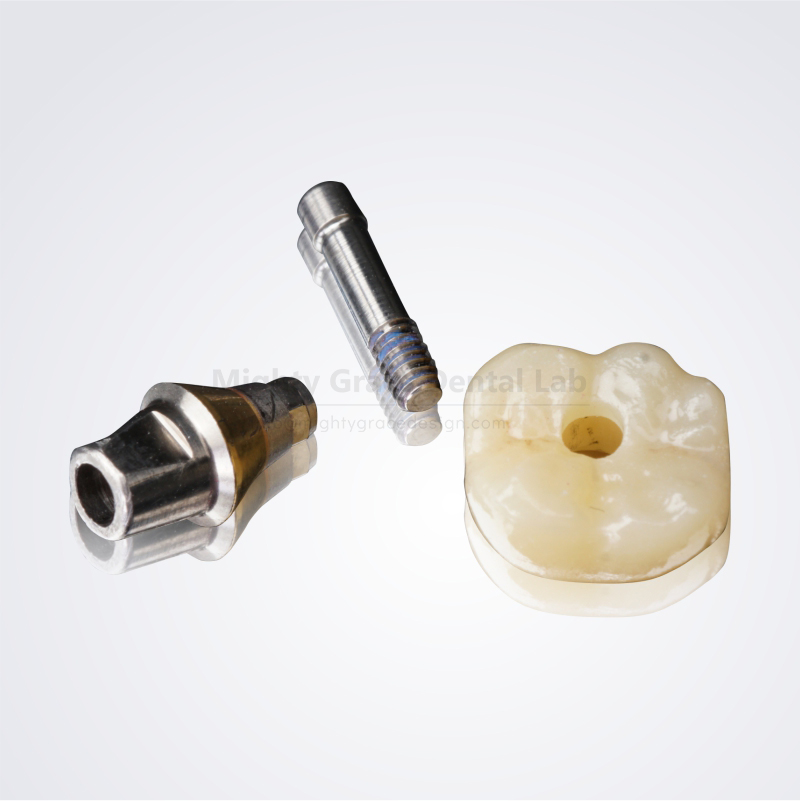 Screw-retained / Cement-retained Crown