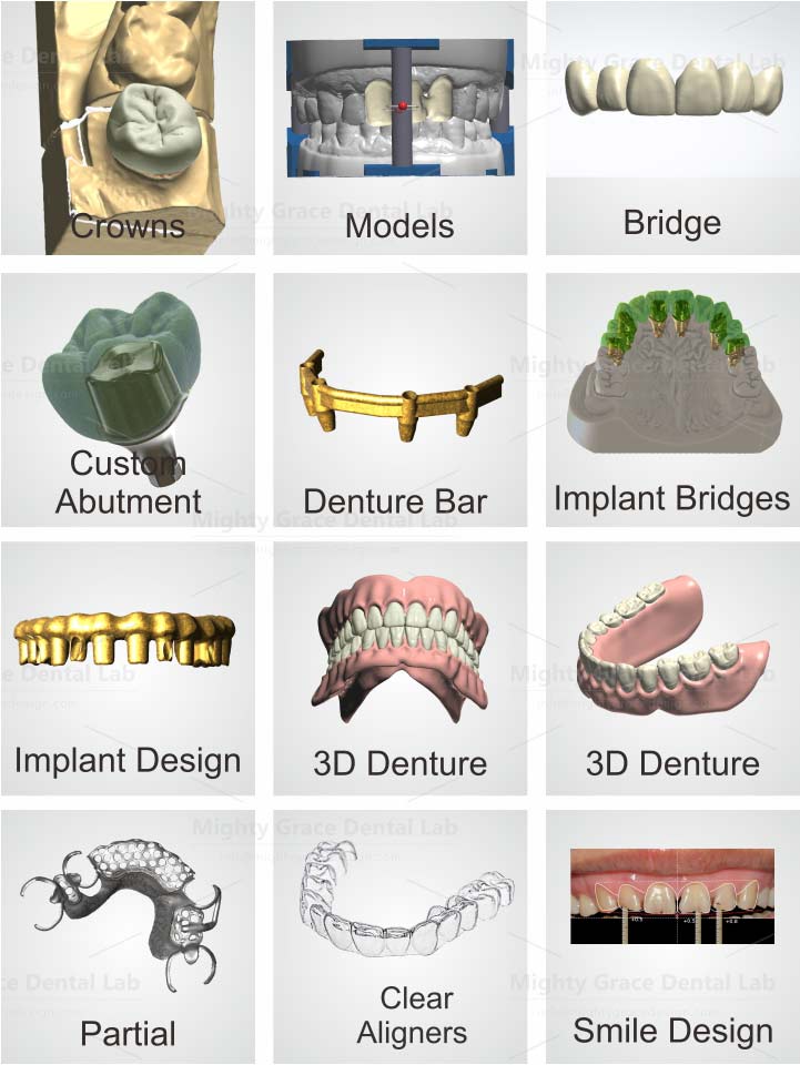 Dental Design Service