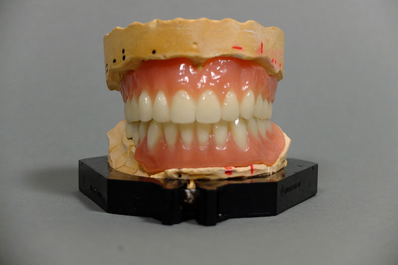 Cost-Effective and Durable: Acrylic Denture Restoration Solution