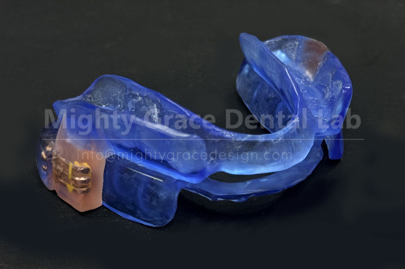 Bid Farewell to Nighttime Disturbances: Anti-Snoring Devices Restore Your Peaceful Sleep