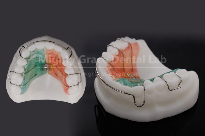 An Effective Tool for Correcting Narrow Dental Arches: Understanding the Standard Spiral Expander