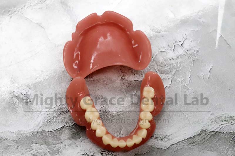 Secure Fit, Natural Living — Full-Arch Suction Dentures Restore Chewing Confidence