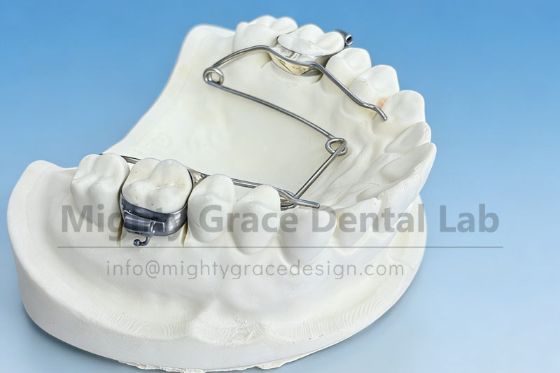 Four-Eye Spring Expander Fabrication: Precision is Key to Clinical Efficacy