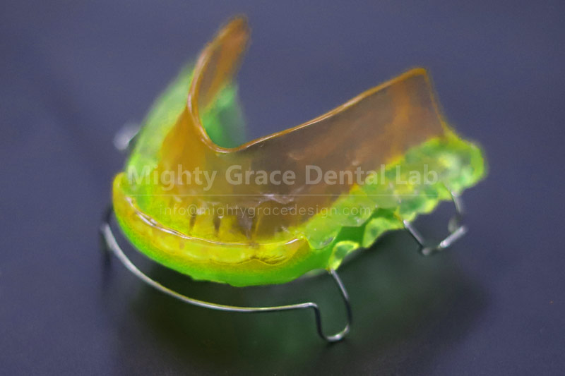 Don't Worry About Your Child's Crooked Teeth: Early Intervention with an Activator Delivers Great Results